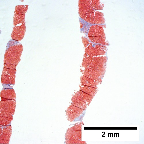 Trichrome shows thin fibrous bands (20X).