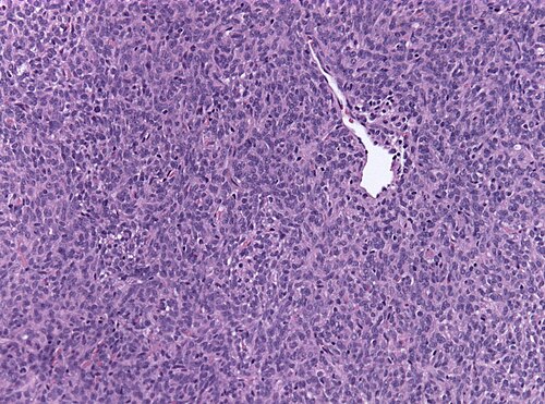 Neuropathology case VI 03.jpg