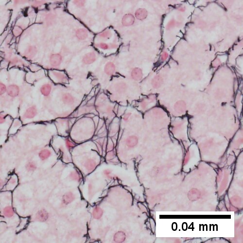 Reticulin stain with regenerative findings, cords with two nuclei thickness, hepatic acini (400X, higher pixel photo)