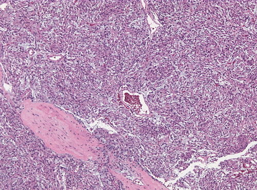 Neuropathology case XI 02.jpg