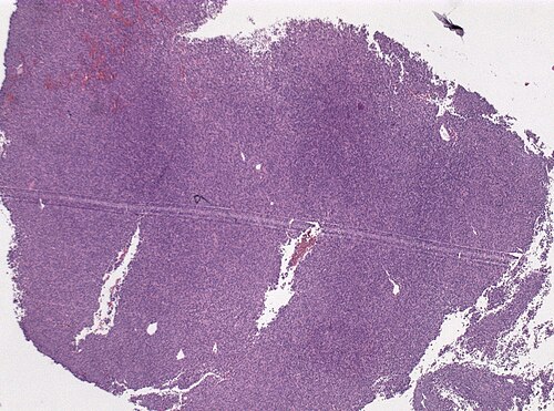 Neuropathology case VI 02.jpg