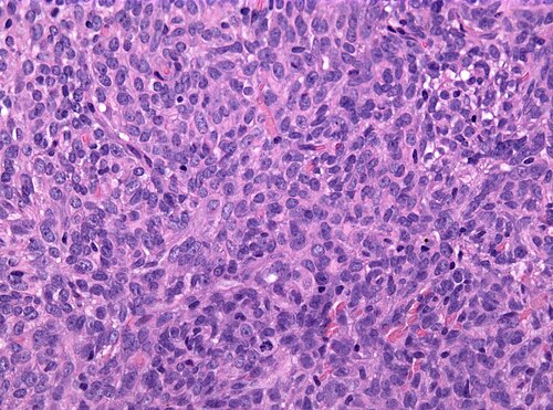 Neuropathology case VI 04.jpg