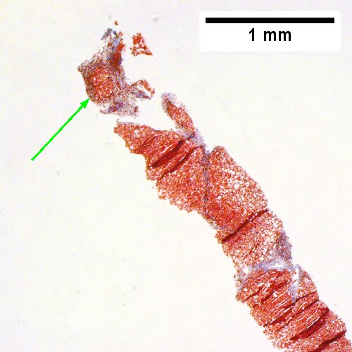 Trichrome also documents early nodule formation (Row 2 Left 40X).