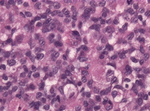 Neuropathology case IV 03.jpg