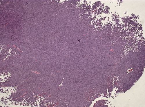 Neuropathology case VII 01.jpg