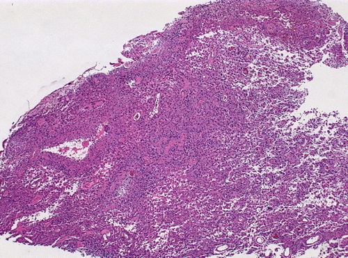 Neuropathology case IX 01.jpg